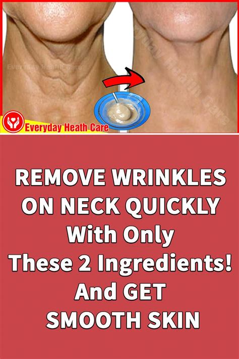 Remove Wrinkles On Neck Quickly With Only These 2 Ingredients And Get