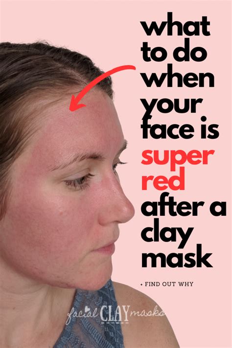 Do You Have Redness After A Clay Mask Heres What To Do