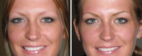 Ugly Black Before And After Makeup Mugeek Vidalondon