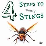Cure For Wasp Sting Pictures