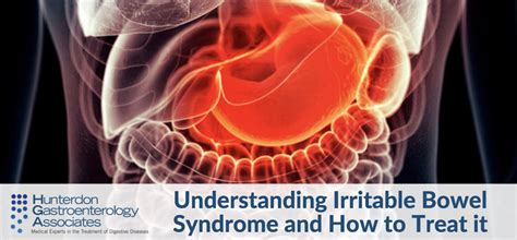 Understanding Irritable Bowel Syndrome And How To Treat It Hunterdon Gastroenterology