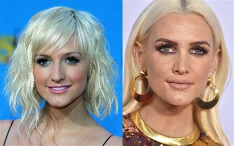 New And Improved The Top Celebrity Plastic Surgeries For The Win