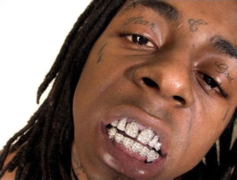 What lil wayne has said about his teeth. Lil Wayne Diamond Teeth Latest online | Top Doctors ...