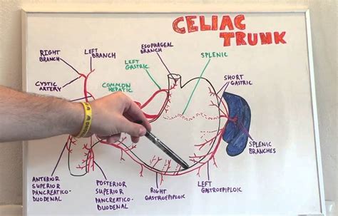 Mark gurarie is a freelance writer, editor, and adjunct lecturer of writing composition at george. Celiac Trunk - Anatomy Lecture for Medical Students ...