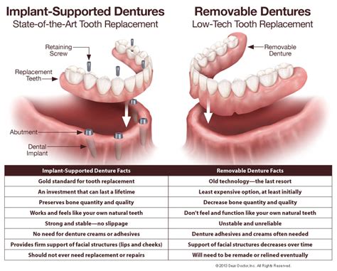 Dentures Partials Guest Dentistry