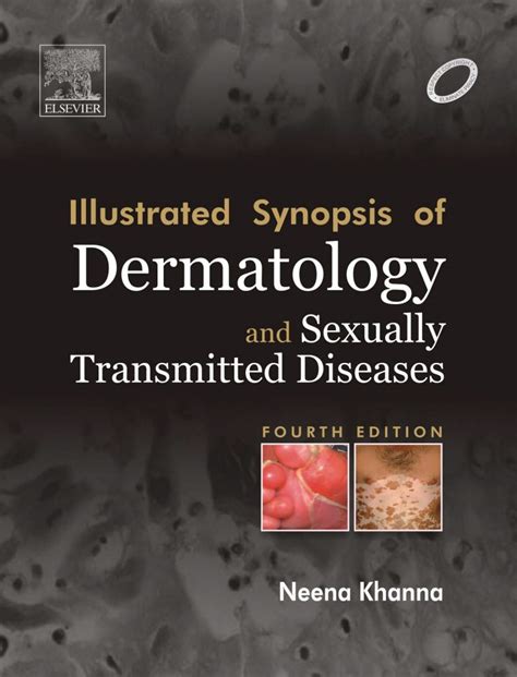 Illustrated Synopsis Of Dermatology And Sexually Transmitted Diseases 4th Edition Ctsqena