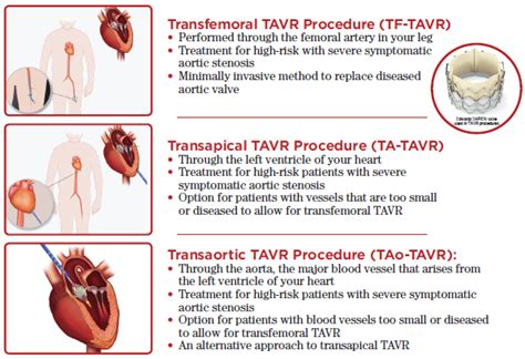 Transcatheter Aortic Valve Replacement Tavr Ut Health East Texas