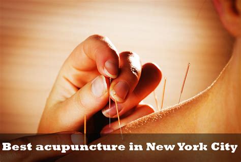 13 Best Acupuncture Nyc New York City December 22 2023