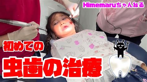 【歯医者さん】5歳の女の子が初めての虫歯の治療！ 子供 ひめまるちゃんねる ひめまる Dentist Youtube