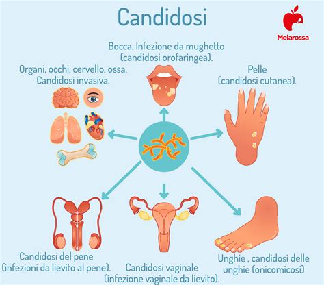 Candida Cos Tipologie Cause Sintomi Cure E Prevenzione