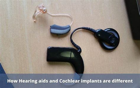 13 Facts That You Should Know About Hearing Aids Vs Cochlear Implants