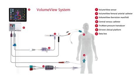 Volumeview System Edwards Lifesciences