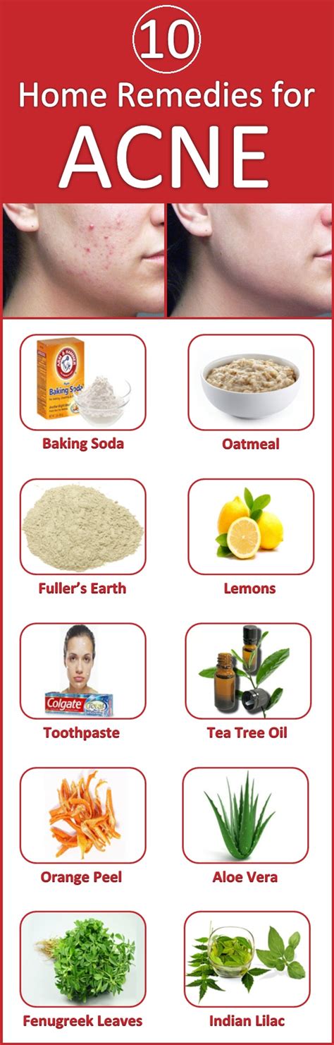 Home Remedies For Acne Active Home Remedies
