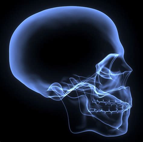 Human Skull X Ray Artwork Photograph By Pasieka