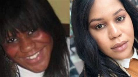Skin Lightening Creams Woman Not Recognised By Father Bbc News