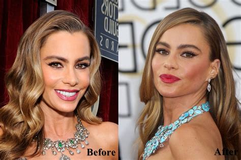 Sofia Vergara Plastic Surgery Face Before And After Photos Plastic Surgery Before And After