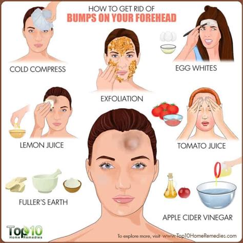 Maybe you would like to learn more about one of these? How to Get Rid of Bumps on Forehead | Top 10 Home Remedies ...