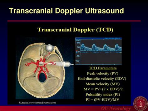 Ppt Introduction To Carotid Ultrasound And Transcranial Doppler