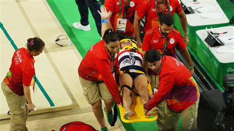 French Gymnast Suffers Horrific Leg Break Graphic