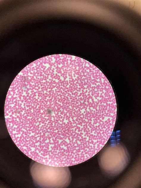 Mitochondria are visible with the light microscope but can't be seen in detail. Red (and a few white) blood cells as seen through an ...