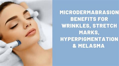 8 Microdermabrasion Benefits For Wrinkles Hyperpigmentation And Melasma