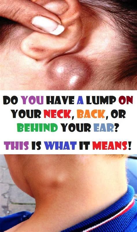Do You Will Have A Lump In Your Neck Back Or Behind Your Ear This Is