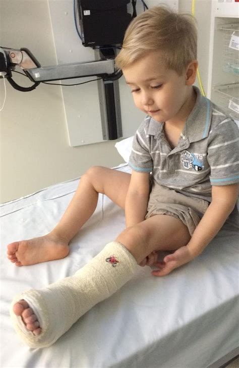 Lady Cilento Childrens Hospital Puts Boys Cast On Wrong