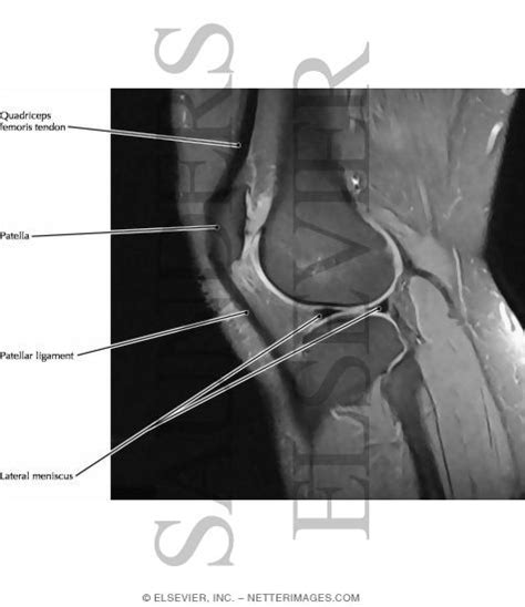 Knee Joint Lateral View