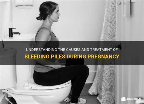 Understanding The Causes And Treatment Of Bleeding Piles During
