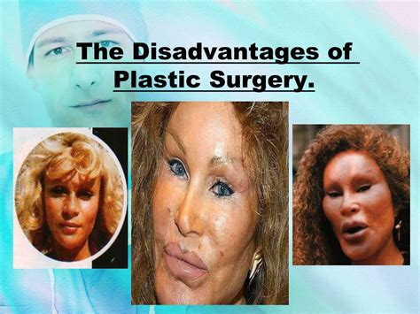 Ppt The Disadvantages Of Plastic Surgery Powerpoint Presentation