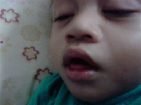 Check spelling or type a new query. Life In c0l0urs..: :: Bibir Pecah & Berdarah