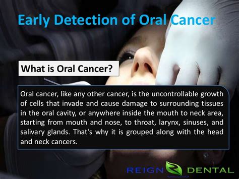 Early Detection Of Oral Cancer 10 Symptoms