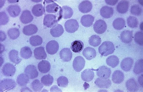 Kostenlose Bild D Nn Film Mikroskopische Aufnahme Immer Lter Plasmodium Malariae Trophozoite