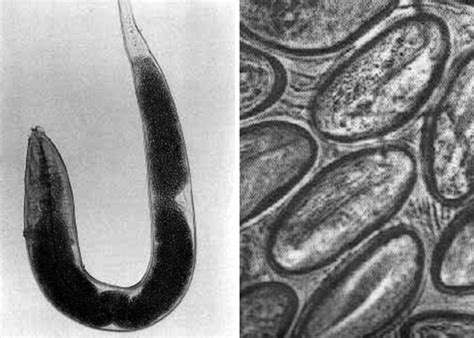 Microscopic Image Of Enterobius Vermicularis A Female B Invasive