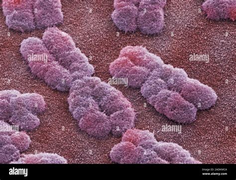 Human Chromosomes Coloured Scanning Electron Micrograph SEM Of Human