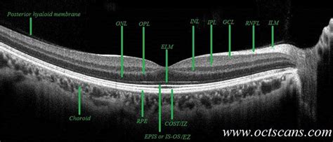 Anatomy Review Optical Coherence Tomography Scans