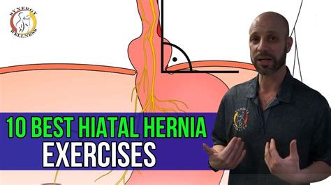 Best Hiatal Hernia Exercises Artofit