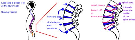 Spine Lumbar Disk Herniation Pinched Nerve — Bone Talks
