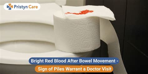 Bright Red Blood After Bowel Movement Sign Of Piles