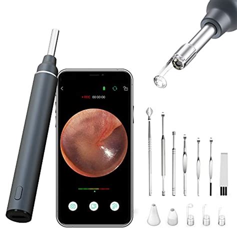 Top 10 Digital Otoscope For Phones Of 2021 Best Reviews Guide