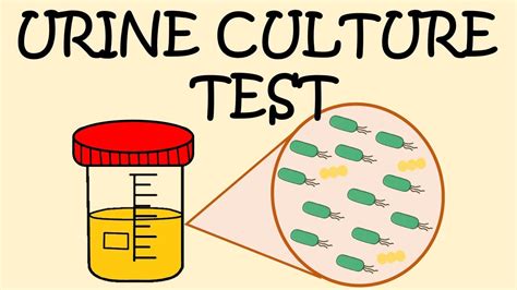 Urine Culture Test How To Collect Urine Sample Youtube