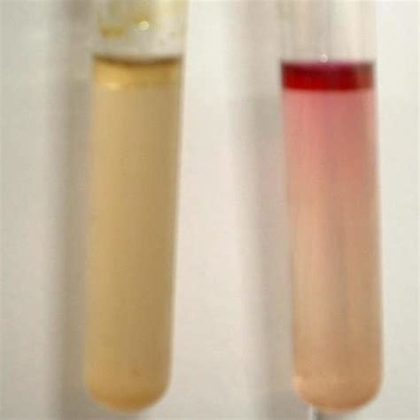 Indole Test Right Test Tube Showing Ve Result Download Scientific