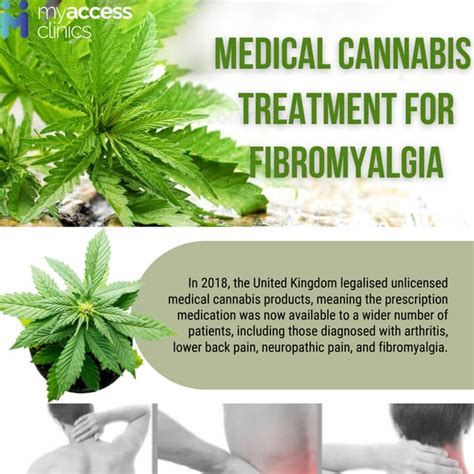 Medical Cannabis Treatment For Fibromyalgiapdf