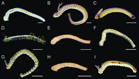 Light Micrographs Showing The Morphologies Of Living Spionid Larvae Of