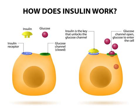 Insulin Resistance Is A Strong Predictor Of Disease Here S What You Need To Know Types Of