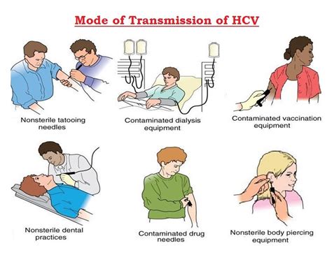 hepatitis c sign and symptoms transmission risk factors diagnosis complication treatment