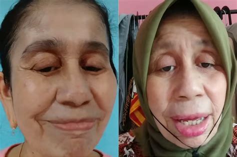 Viral Wajah Wanita Usia 28 Tahun Di Bogor Seperti Nenek Nenek