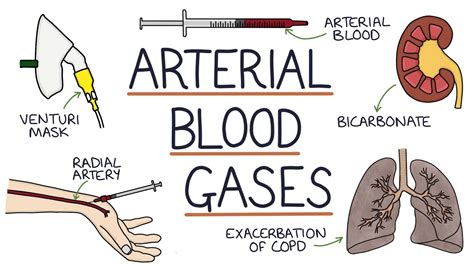 Arterial Blood Gas Broward Miami Health Institute