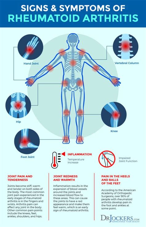 Rheumatoid Arthritis Symptoms Causes And Natural Support Strategies Rheumatoid Arthritis