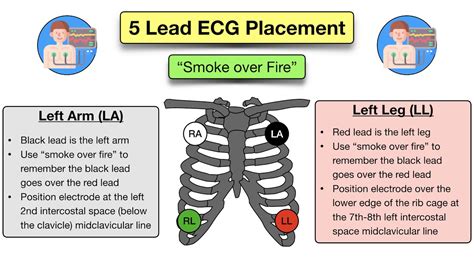 How To Place A 5 Lead Ecg Acronym Mnemonic Diagram For Electrode